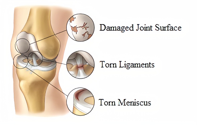 Diagram of knee interior